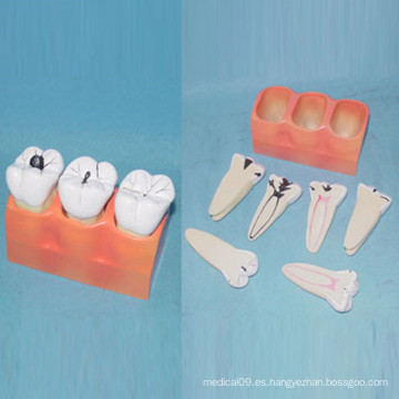 Modelo dental de la anatomía de los dientes del cuidado dental para la enseñanza (R080117)